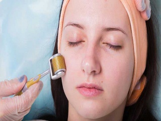 میکرونیدلینگ پوست