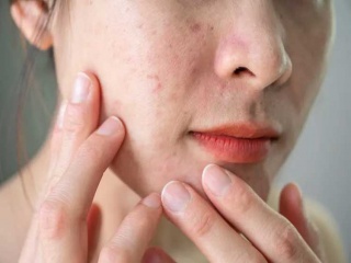 چطور پوست زیباتری داشته باشیم